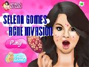 Selena Gomes Acne Invasion